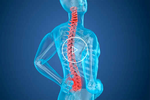 腰椎间盘突出的那些事儿